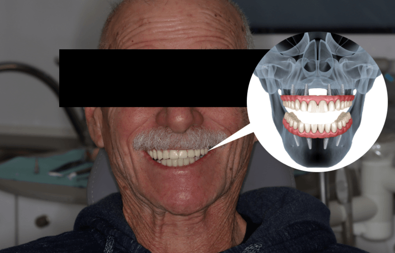 dental reconstruction