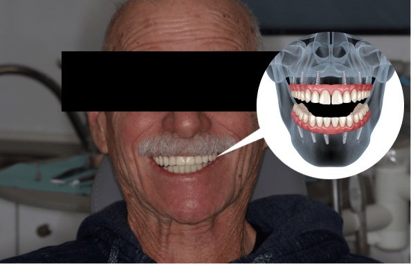 dental reconstruction